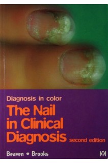 The Nail in Clinical Diagnosis 2nd Edition. D. W. Beaven Stafford E. Brooks