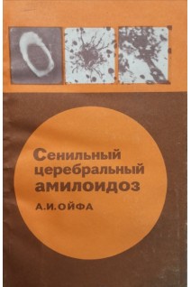 Сенильный церебральный амилоидоз (БУ). Ойфа А.И.