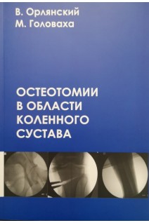 Остеотомии в области коленного сустава. Орлянский В. Головаха М.