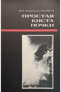Простая киста почки (БУ). Лопаткин Н.А. Мазо Е.Б.