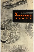Халькоз глаза (БУ). Алексеева В.И.