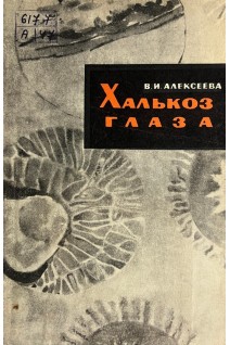 Халькоз глаза (БУ). Алексеева В.И.