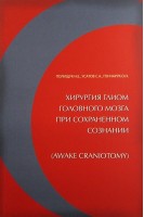 Хирургия глиом головного мозга при сохраненном сознании. Полищук Н.Е.