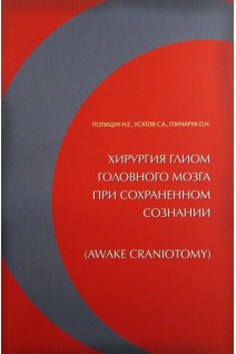 Хирургия глиом головного мозга при сохраненном сознании. Полищук Н.Е.
