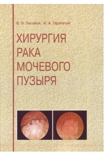Хирургия рака мочевого пузыря. Лесовой В.Н. Гарагатый И.А.