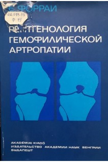 Рентгенология гемофилической артропатии (БУ). Форраи Е.