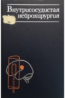Внутрисосудистая нейрохирургия (БУ). Хилько В.А.