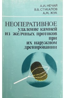 Неоперативное удаление камней из желчных потоков при наружном дренировании (БУ). Нечай А.И.