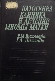 Патогенез клиника и лечение миомы матки (БУ). Вихляева Е.М. Паллади Г.А.