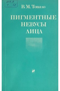 Пигментные невусы лица. Топало В.М.