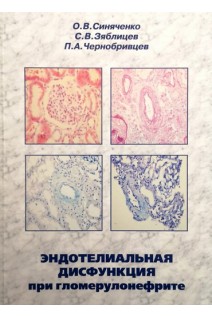 Эндотелиальная дисфункция при гломерулонефрите. Синяченко О.В. Зяблицев С.В. Чернобривцев П.А.