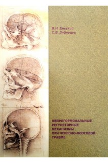 Нейрогормональные регуляторные механизмы при черепно-мозговой травме. Ельский В.Н. Зяблицев С.В.