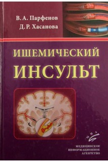 Ишемический инсульт. Парфенов В.А. Хасанова Д.Р.