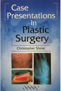 Case Presentations in Plastic Surgery. Stone C