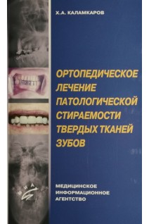 Ортопедическое лечение патологической стираемости твёрдых тканей зуба. Каламкаров Х.А.