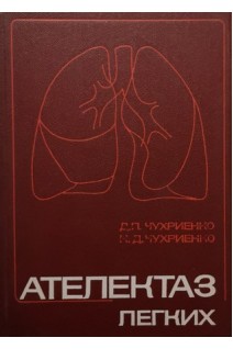 Ателектаз легких (БУ). Чухриенко Д.П.