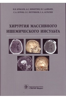 Хирургия массивного ишемического инсульта. Крылов В.В. и др.
