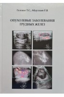 Опухолевые заболевания грудных желез. Головко Т.С. Абдуллаев Р.Я.