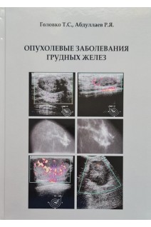 Опухолевые заболевания грудных желез. Головко Т.С. Абдуллаев Р.Я.
