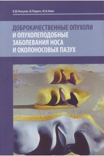 Доброкачественные опухоли и опухолеподобные заболевания носа и околоносовых пазух. Носуля Е.В. Перич Б. Ким И.А.