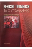 Венозні тромбози та їх ускладнення. Ковальчук Л.Я. Венгер І.К. Гощинський В.Б.