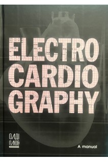 Electrocardiography: a manual. Yakymenko O. Kolomiiets S. Smal V. Sebov D. Tbilieli V.