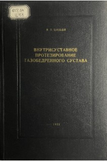 Внутрисуставное протезирование тазобедренного сустава (БУ). Цивьян Я.Л.