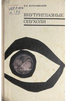 Внутриглазные опухоли (БУ). Котелянский Э.О.