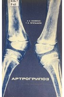 Артрогрипоз (БУ). Розовская Л.Е. Тер-Егиазаров Г.М.