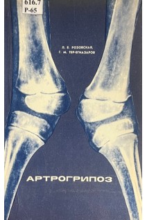 Артрогрипоз (БУ). Розовская Л.Е. Тер-Егиазаров Г.М.
