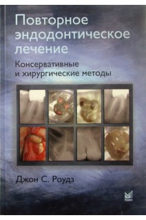 Повторное эндодонтическое лечение. Консервативные и хирургические методы.. Роудз Джон С.