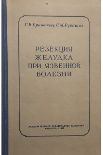 Резекция желудка при язвенной болезни (БУ). Кривошеев С.В.