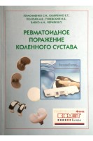 Ревматоидное поражение коленного сустава. Герасименко С.И. Скляренко Е.Т. Полулях М.В.