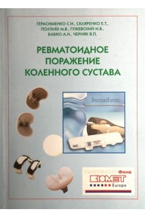 Ревматоидное поражение коленного сустава. Герасименко С.И. Скляренко Е.Т. Полулях М.В.