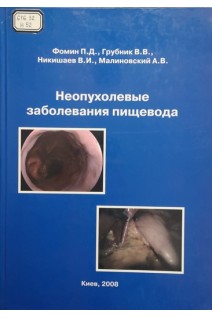 Неопухолевые заболевания пищевода (БУ). Фомин П.Д. Грубник В.В. Никишаев В.И. Малиновский А.В.