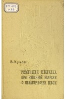 Резекция желудка при язвенной болезни с механическим швом (БУ). Кукош В.