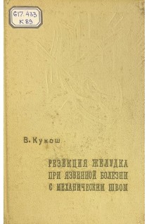 Резекция желудка при язвенной болезни с механическим швом (БУ). Кукош В.