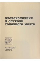 Кровоизлияния в опухоли головного мозга (БУ). Тиглиев Г.С.