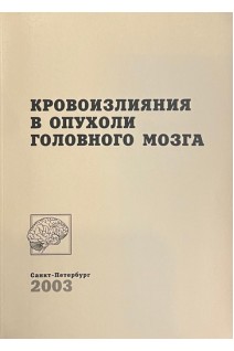 Кровоизлияния в опухоли головного мозга (БУ). Тиглиев Г.С.