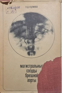 Магистральные сосуды брюшной аорты (БУ). Кулиева Х.Д.