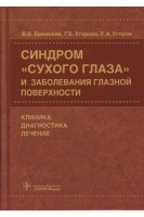 Синдром сухого глаза и заболевания глазной поверхности: клиника диагностика лечение. Бржеский В.В. Егорова Г.Б. Егоров Е.А.