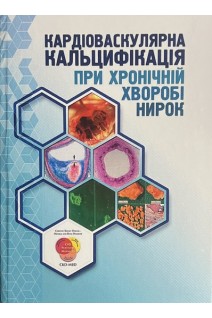 Кардіоваскулярна кальцифікація при хронічній хворобі нирок: монографія. Сусла О.Б. Гоженко А.І. та ін.