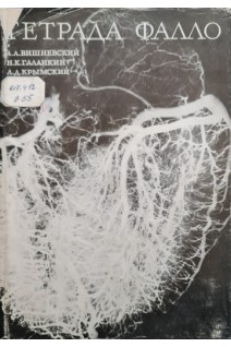 Тетрада Фалло (БУ). Вишневский А.А.