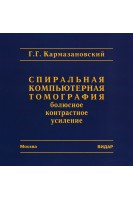 CD. Спиральная компьютерная томография: болюсное контрастное усиление. Кармазановский Г.Г.