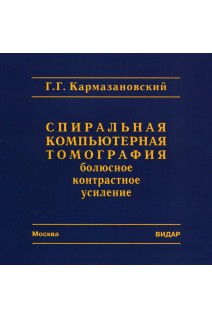 CD. Спиральная компьютерная томография: болюсное контрастное усиление. Кармазановский Г.Г.