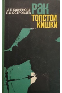 Рак толстой кишки (БУ). Баженова А.П.
