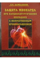 Защита миокарда при кардиохирургических операциях с искусственым кровообращеним. Цымбаленко К.И.