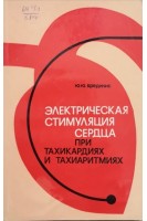 Электрическая стимуляция сердца при тахикардиях и тахиаритмиях. Бредикис Ю.Ю.