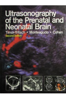 Ultrasonography of the Prenatal and Neonatal Brain. Ilan Timor-Tritsch and Ana Monteagudo