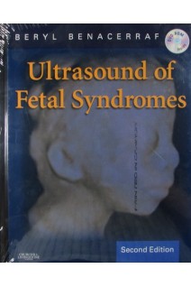 Ultrasound of Fetal Syndromes. Beryl R. Benacerraf